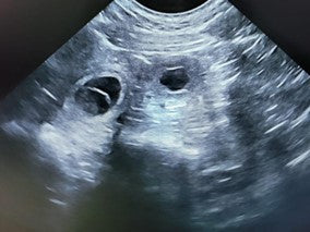 Canine Pregnancy Loss – Embryonic Death